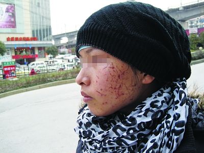 南京一KTV服务员遭一群男子暴打 几乎毁容