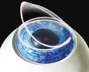 徐州眼科专家称激光手术风险可控