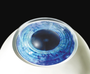 徐州眼科专家称激光手术风险可控