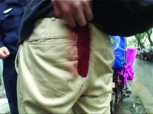 喊了声有人偷包南京好心头像被捅女生90后臀部可爱qq小伙图片