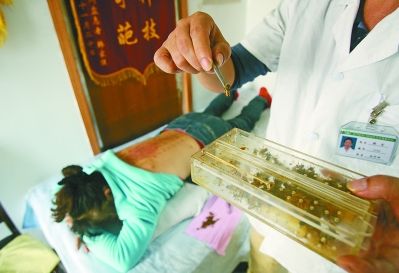 收费低传人少 南京中医蜂疗技艺濒临失传