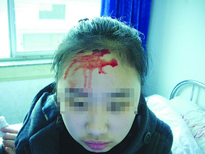 眼睛流血肚子<em>长腿</em>脸上生毛 盘点全球变异人_江